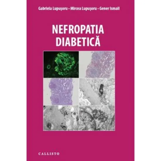Nefropatia Diabetica - Gabriela Lupusoru, Mircea Lupusoru, Gener Ismail Nefropatia Diabetica - Gabriela Lupusoru, Mircea Lupusoru, Gener Ismail