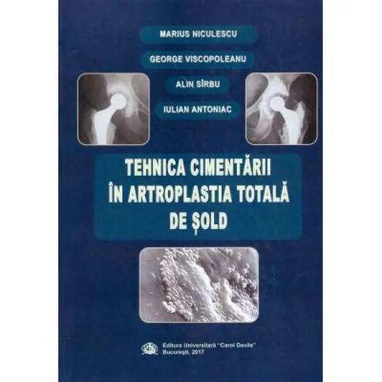 Tehnica cimentarii in artroplastia totala de sold - Marius Niculescu, George Viscopoleanu, Alin Sirbu, Iulian Antoniac Tehnica cimentarii in artroplastia totala de sold - Marius Niculescu, George Viscopoleanu, Alin Sirbu, Iulian Antoniac